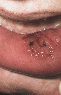 fakenut | trị liệu